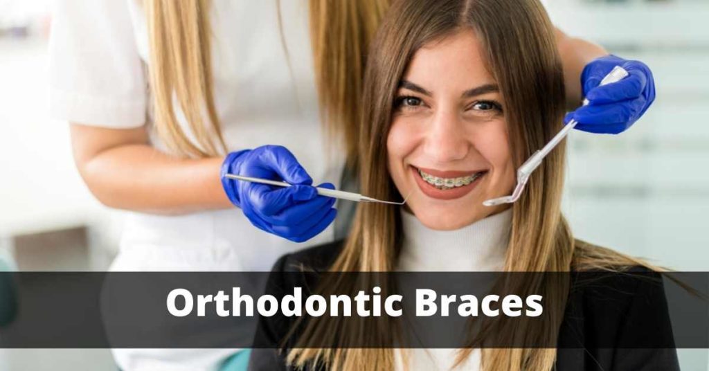 Orthodontic Braces Blogging